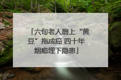 六旬老人唇上“黄豆”拖成癌 四十年烟瘾埋下隐患